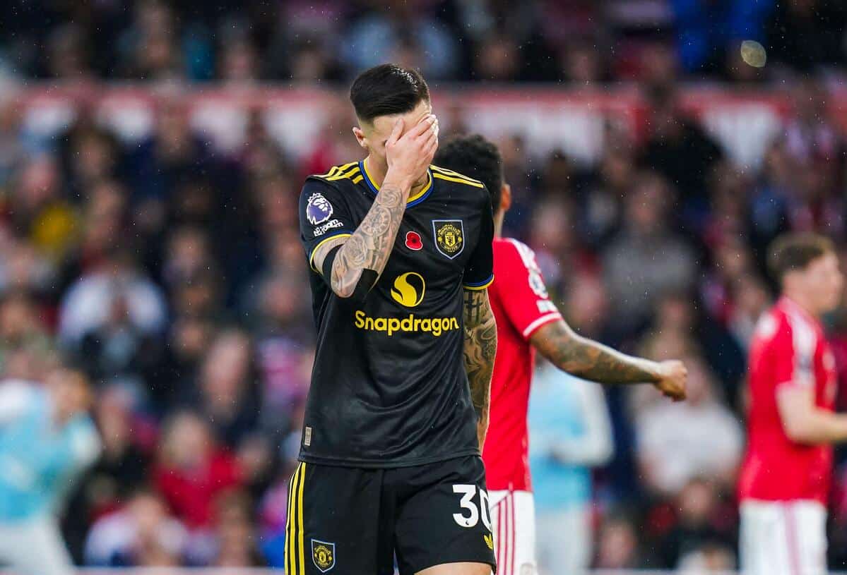 Manchester United striker Cesko's injury is not that serious